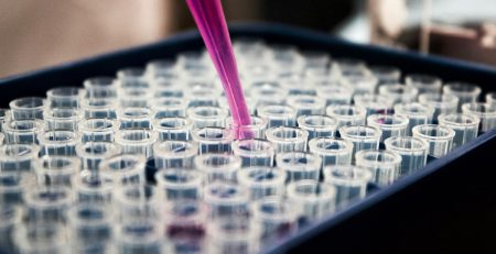 pipette