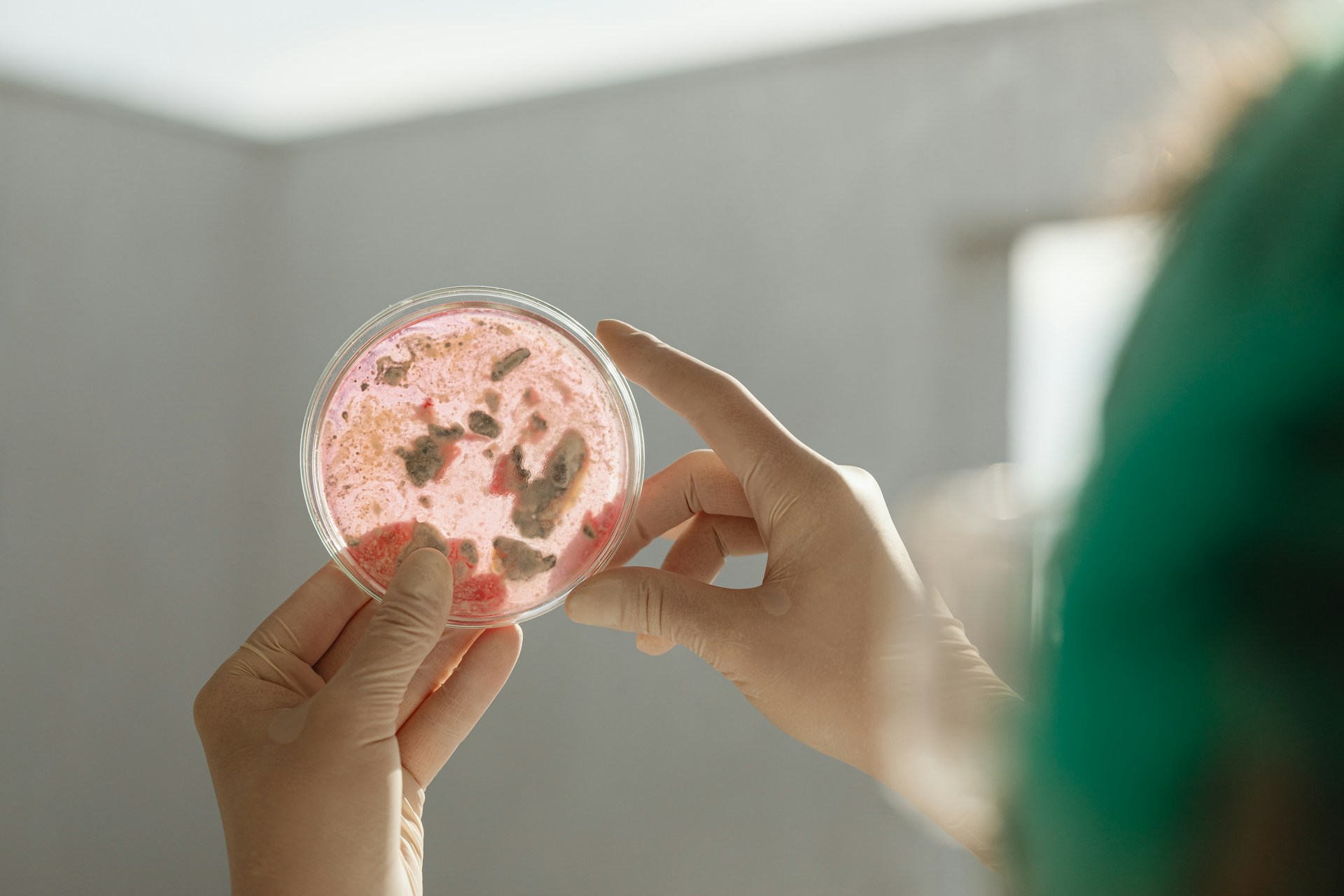 microbiology