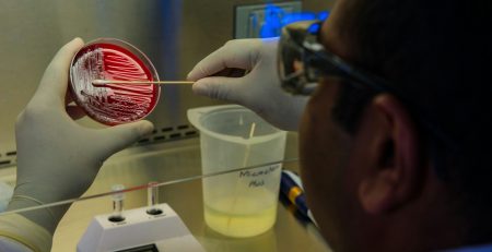 petri dish