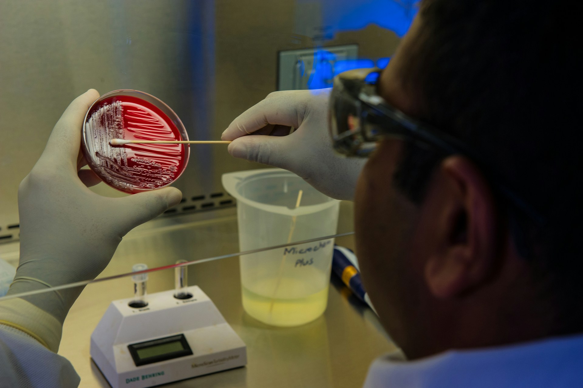 petri dish