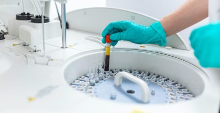 Benchtop Centrifuge