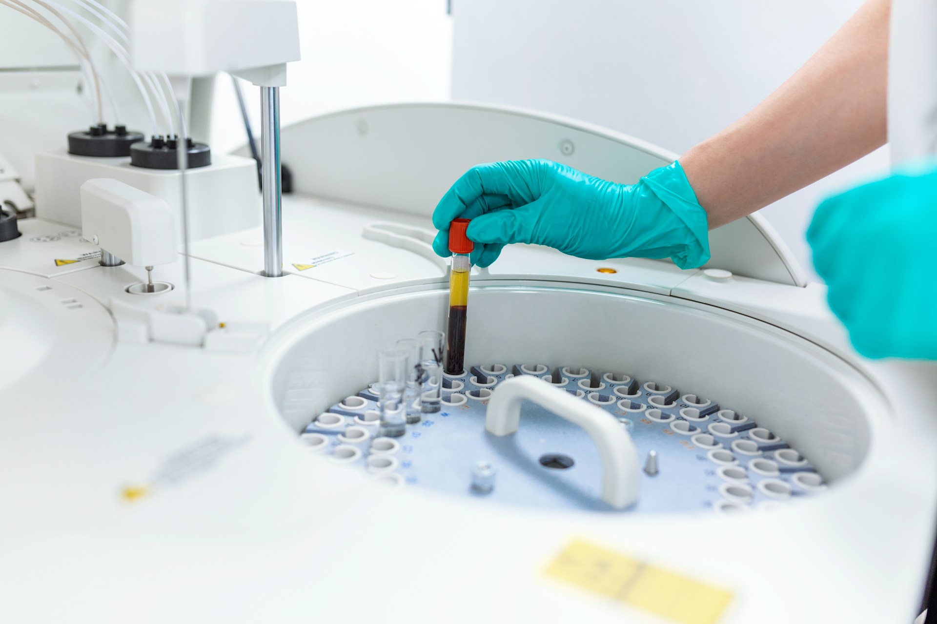 Benchtop Centrifuge