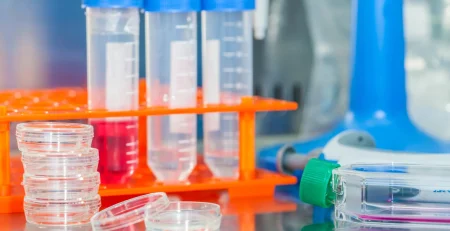 lab plasticware