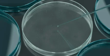 Petri Dish