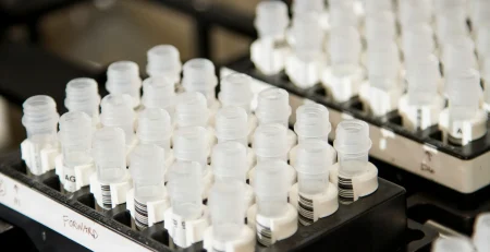 lab plasticware
