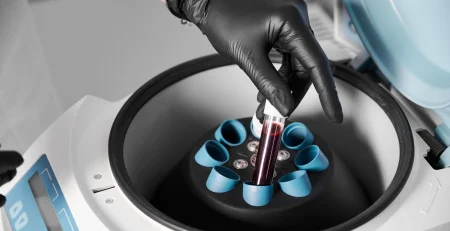 vortex mixer