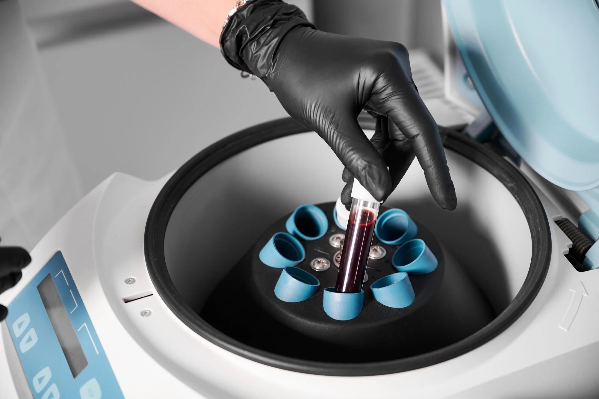 vortex mixer